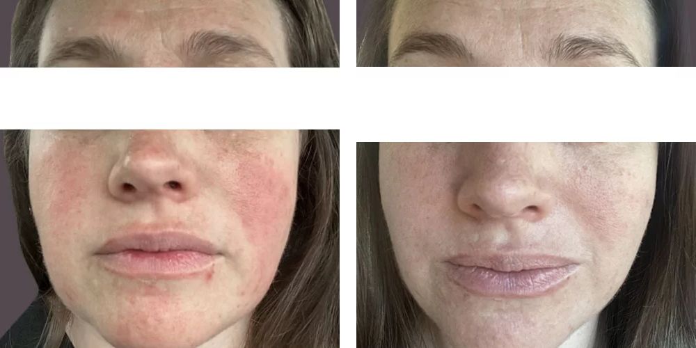 Client result 1
