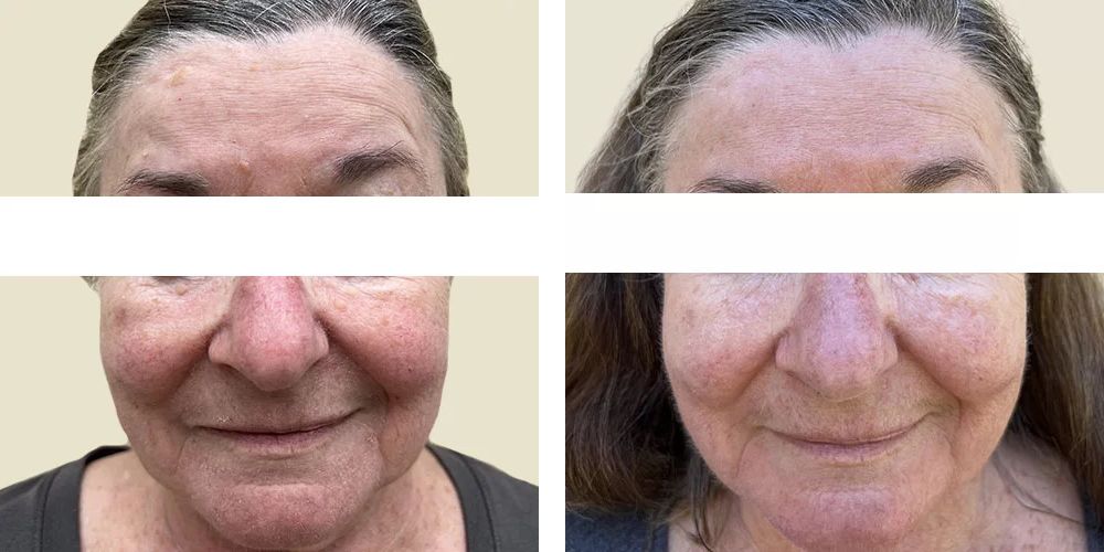 Client result 2