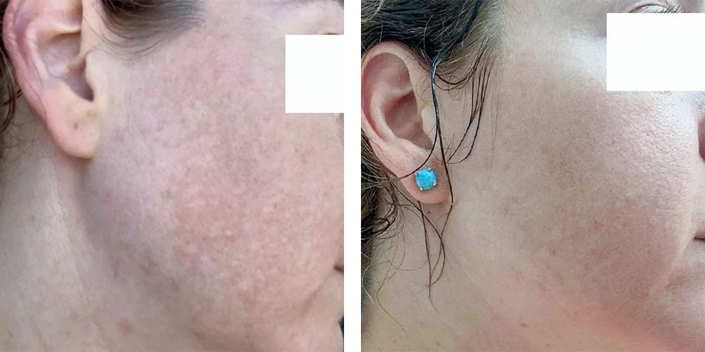 Client result 3