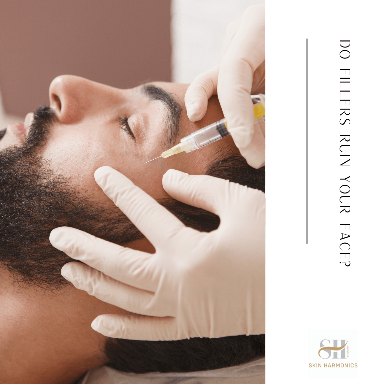 Do Fillers Ruin Your Face?