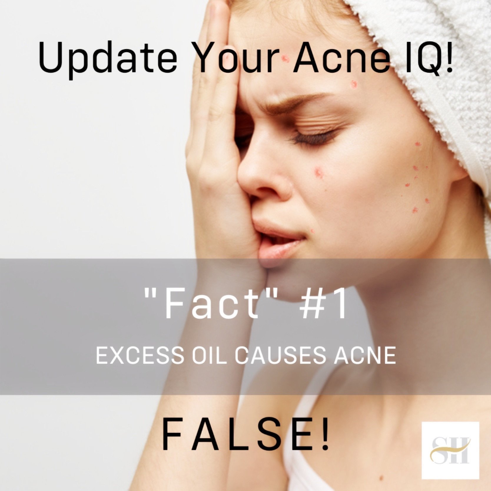 Does Excess Oil Cause Acne? - Skin Mythbusting