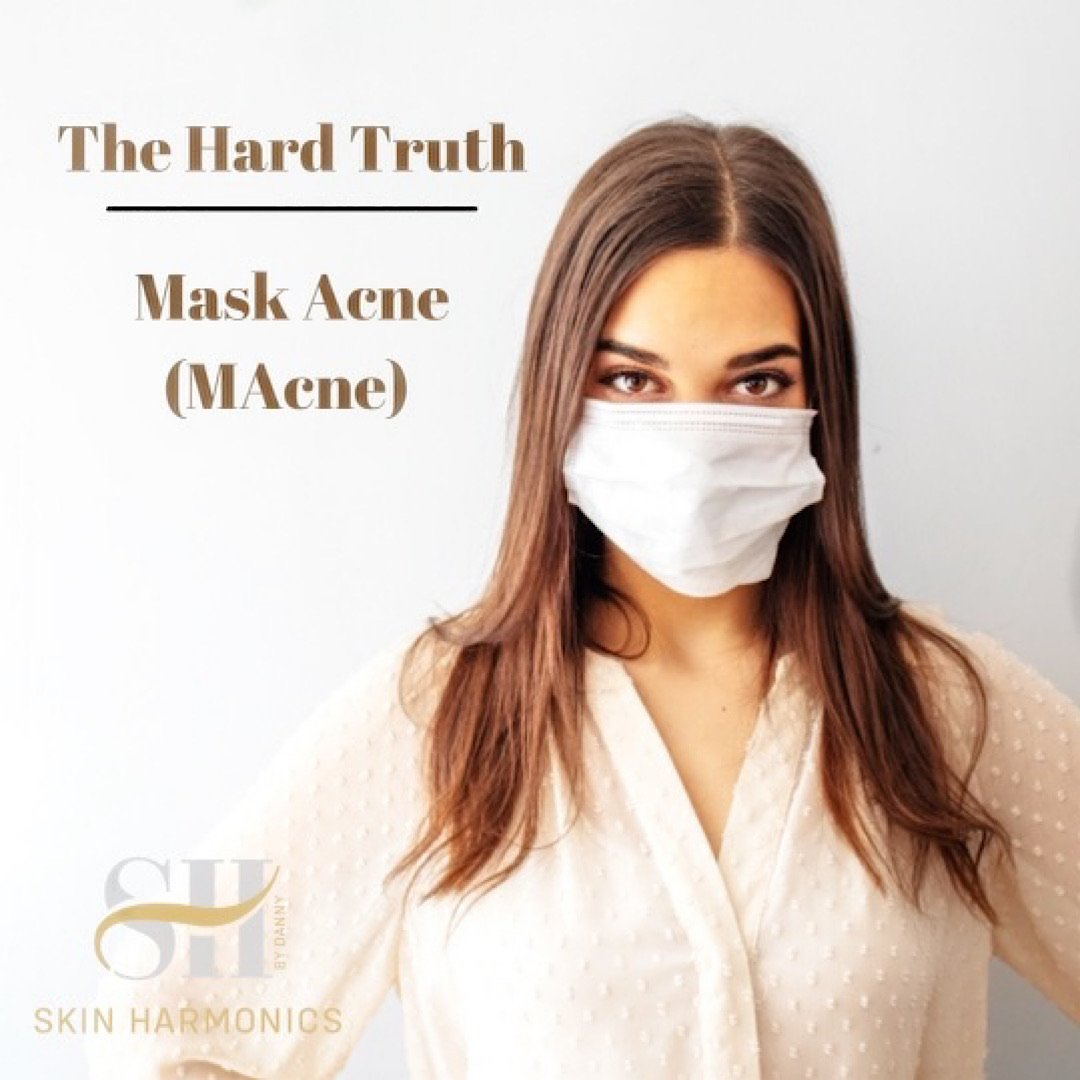 How To Treat Macne Caused By Face Masks