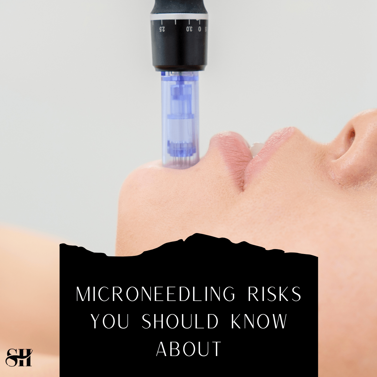Microneedling Risks You Should Know