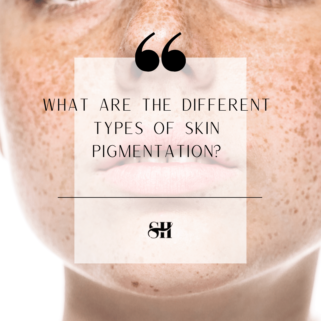 Types of Skin Pigmentation