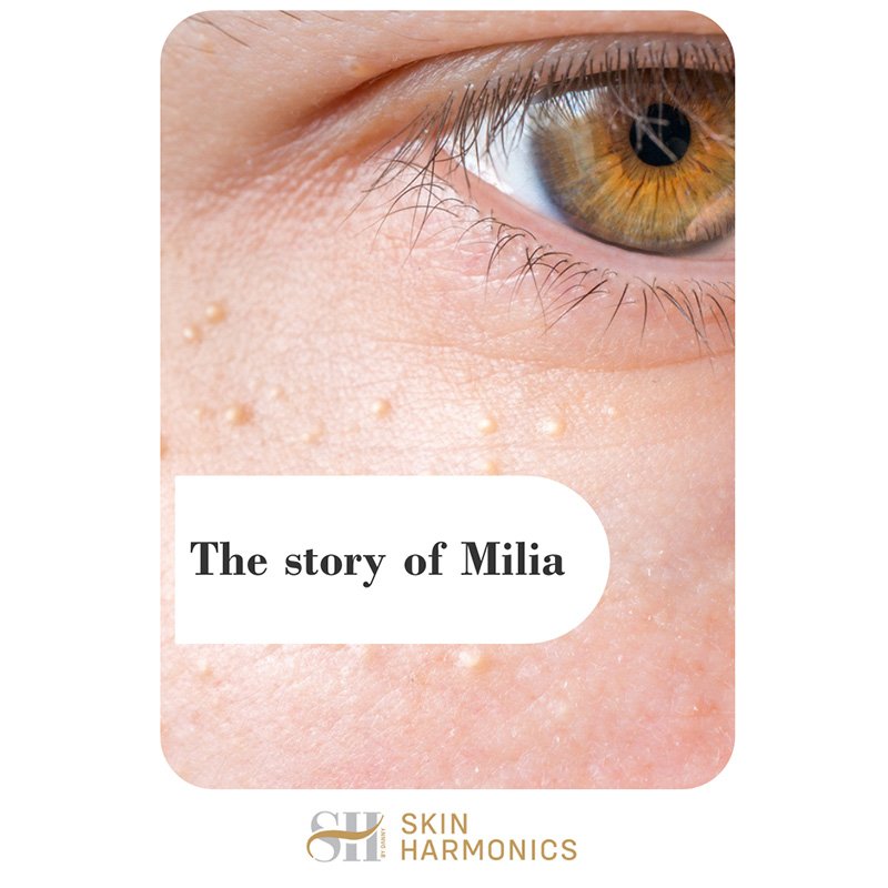 What Is Milia?