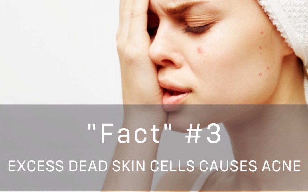 does excess dead skin cause acne
