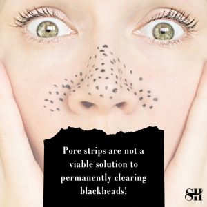 The Truth About Pore Strips and Blackheads