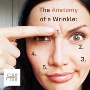 Five Main Things That Cause Wrinkles