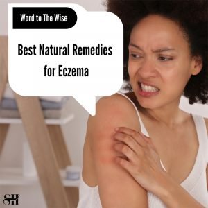 Best Natural Remedies for Eczema
