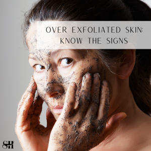 Over Exfoliated Skin: Know the Signs