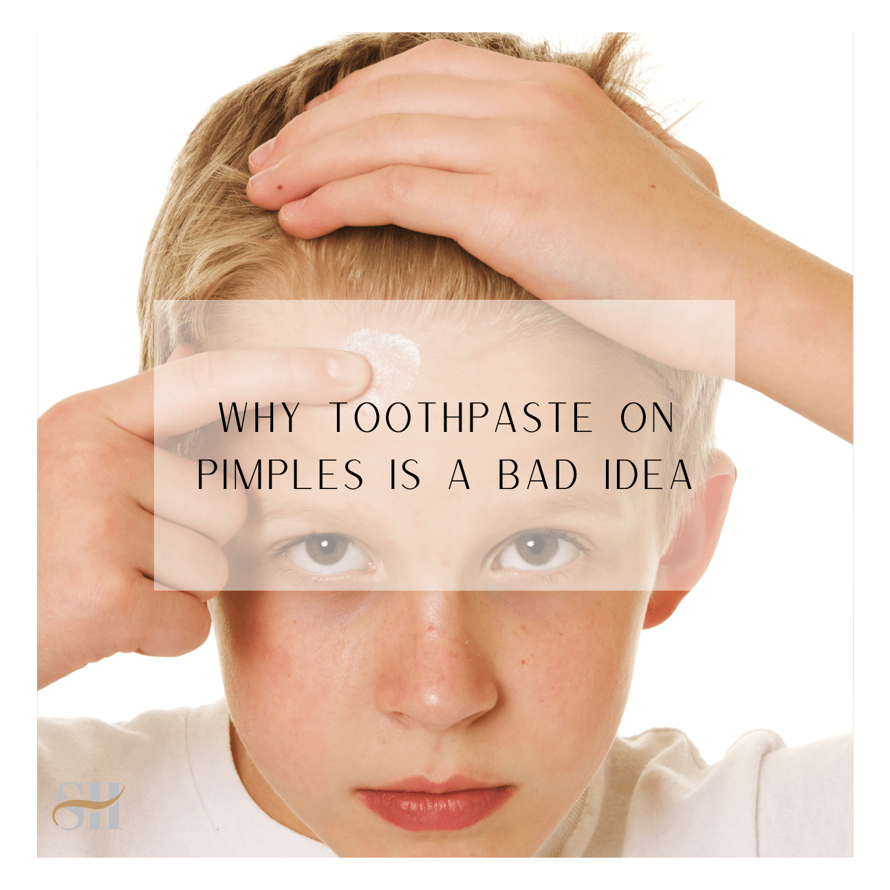 Why Toothpaste On Pimples Is A Bad Idea Skin Harmonics