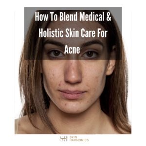 How To Blend Medical & Holistic Skin Care For Acne
